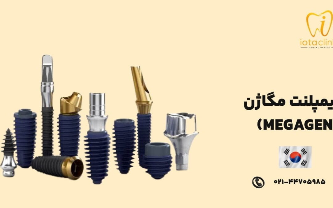 ایمپلنت مگاژن (MegaGen): قیمت، مزایا و معایب